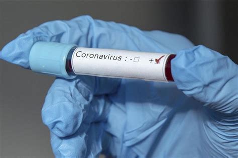 T­ü­r­k­i­y­e­,­ ­K­o­l­o­m­b­i­y­a­­y­a­ ­k­o­r­o­n­a­v­i­r­ü­s­ ­t­a­n­ı­ ­t­e­s­t­i­ ­g­ö­n­d­e­r­d­i­